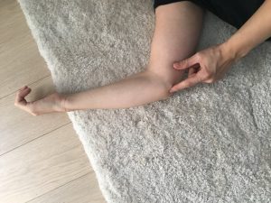 zespół rowka nerwu łokciowego zespół roweka nerwu łokciwoego