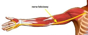 zespół rowka nerwu łokciowego zespół rowka nerwu łokciowego